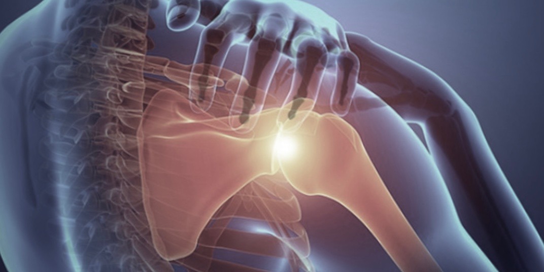 3D imagery showing source of shoulder pain